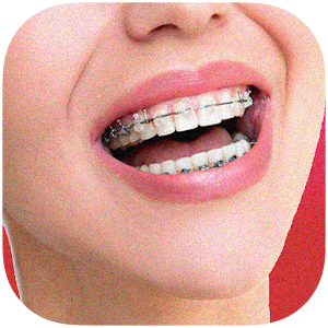 Download Braces Teeth Color Photo make For PC Windows and Mac