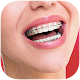 Download Braces Teeth Color Photo make For PC Windows and Mac 1.0