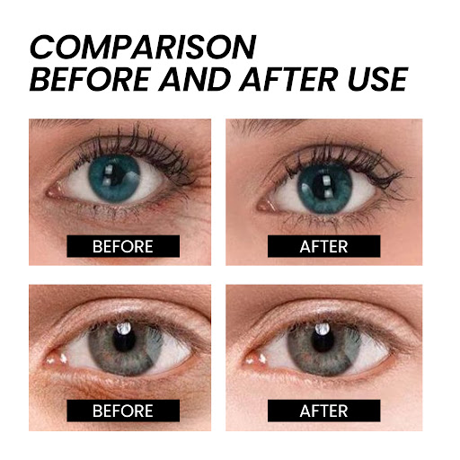 Title 2, Firming Eye Cream for Wrinkles and Eye Bags. Re...