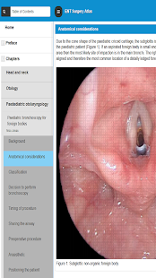How to download ENT Surgery Atlas lastet apk for laptop