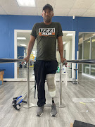 Cameron Africa was fitted with a prosthetic leg donated by Zimele NPO.