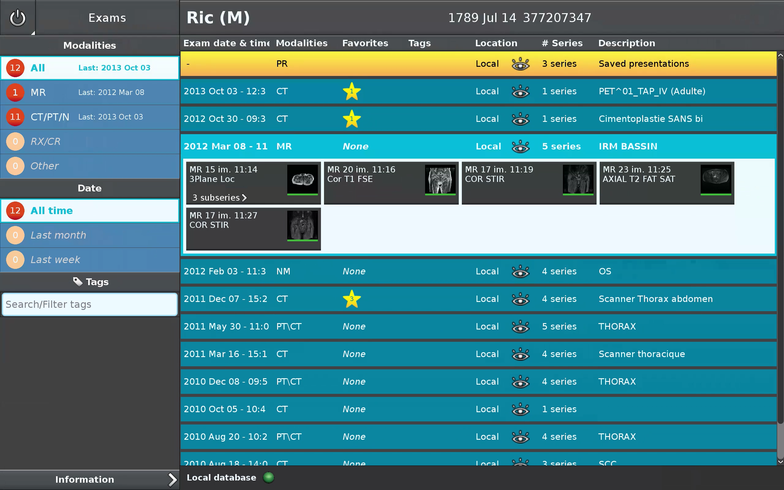 Android application Anywhere Streaming screenshort