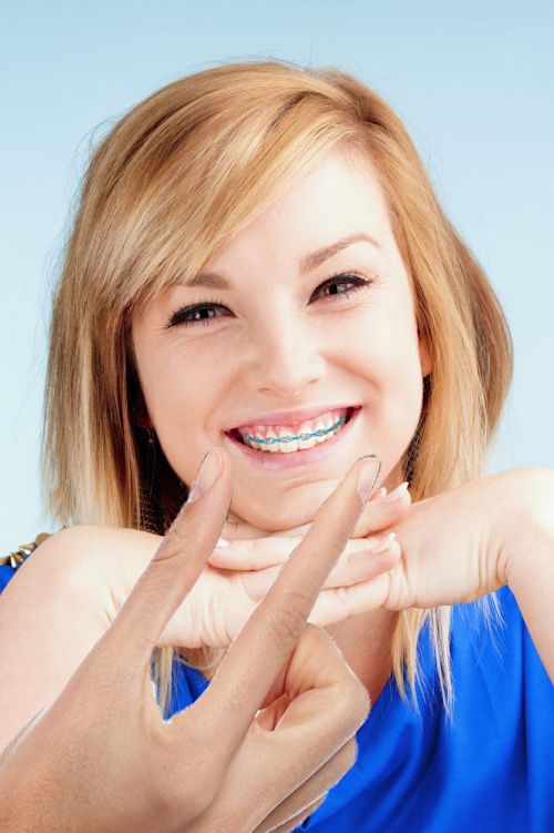 Android application Fake Braces screenshort