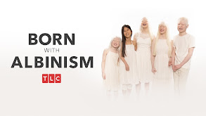 Born With Albinism thumbnail