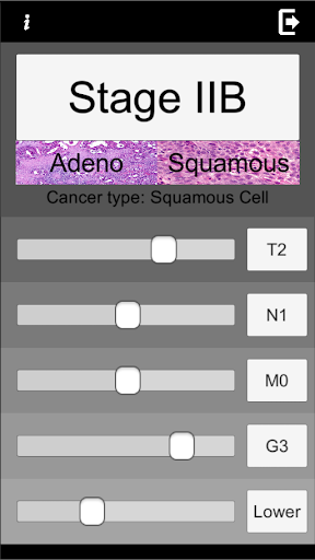 Esophageal Cancer Staging TNM