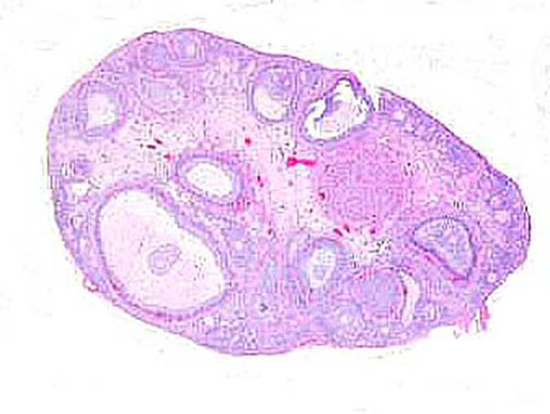 The other ovary with one corpus luteum.