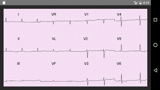  ECG 100 Clinical Cases – ескіз знімка екрана  