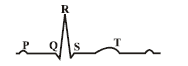 ECG