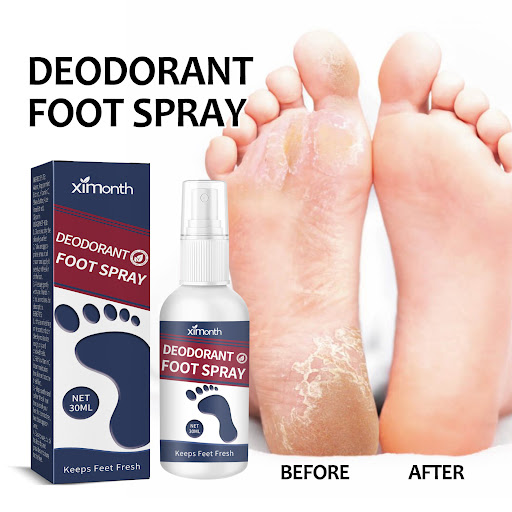 Title 1, Foot Chapped Replenishment Care Spray Moisturiz...