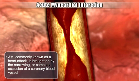 Medrills: Cardiac Emergencies(圖4)-速報App