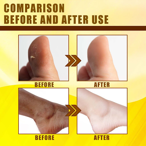 Title 5, Tender Brightening Body Cleaning Yellow Skin Oil
