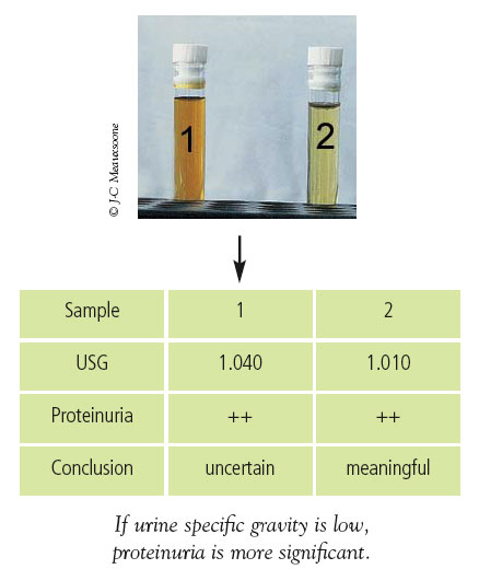 Interpretation of proteinuria based on urinary density