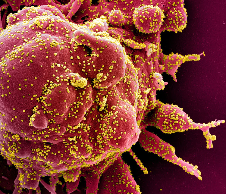 A colourised scanning electron micrograph of an apoptotic cell (red) infected with SARS-Cov-2 virus particles (yellow), also known as the coronavirus, isolated from a patient sample. Image captured at the NIAID Integrated Research Facility in Fort Detrick, Maryland. National Institute of Allergy and Infectious Diseases. NIH HANDOUT VIA REUTES