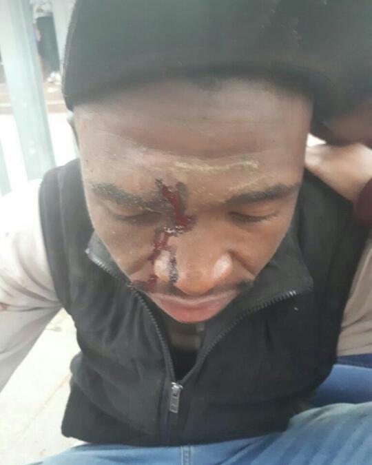 A Walter Sisulu University student was injured when students at the Mthatha campus fought with security guards on Sunday Picture: SUPPLIED