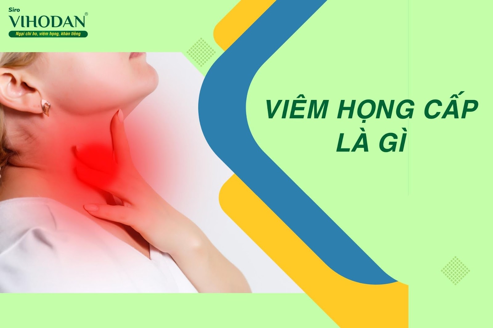 Viêm họng cấp là tình trạng viêm nhiễm cấp tính niêm mạc thành sau họng