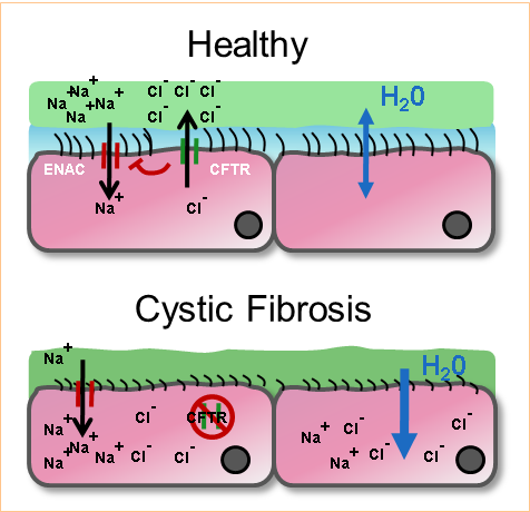 Microbial infection in cystic fibrosis - Figure 1