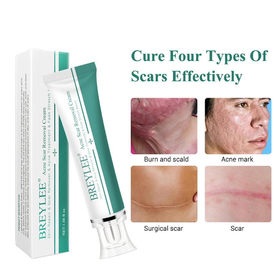 Crème Réparatrice Visage Soin Anti-Âge Réduit Rides Hydrate Intensément Nourrit et Répare la Peau Abîmée Pour une Peau Radieuse