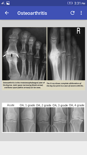 Musculoskeletal X- Rays Interpretation