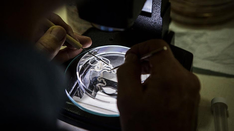 The Guinea worm under the microscope. Picture: CARTER CENTER/J HAHN