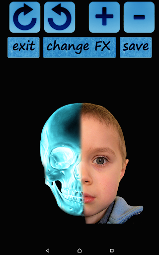 Xray Photo Creator