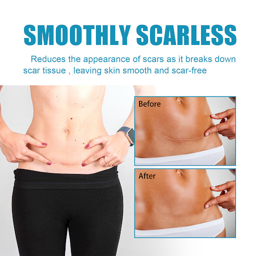 Title 3, Softening and Smoothing Scar Gel Gentle Moistur...