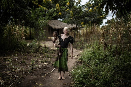 Mainasi Issa, a 23-year-old Malawian albino woman, carries her tow-year-old daughter Djiamila Jafali as she poses outside her hut in the traditional authority area of Nkole, Machinga district, on April 17, 2015. File photo