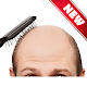 Download Hair Loss/Fall Treatment For PC Windows and Mac 1.0