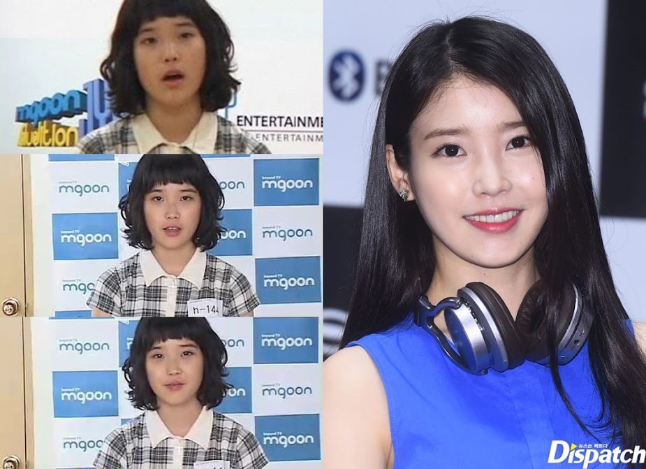 IU_beforeafter