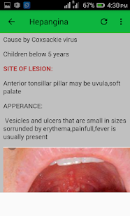 Pediatric Skin Disorders(圖8)-速報App
