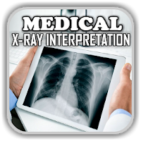 X-Ray Interpretation  Medical Chest X Ray Cases