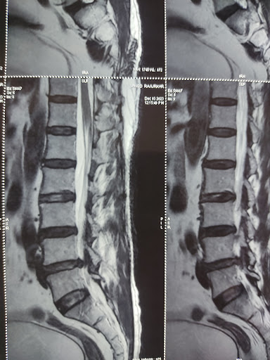 Dr Nawale orthopaedic Hospital Best/ Spine/ Surgeon/Near/ Endoscopic Spine/Orthopaedic Doctor/Orthopaedic Hospital — business photo 6