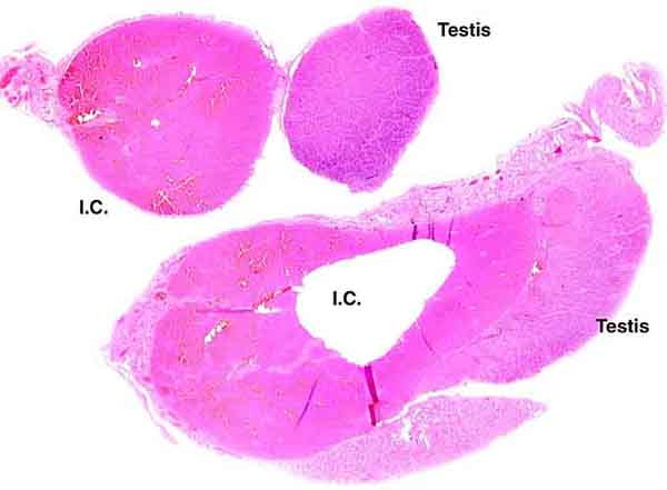 Neonatal testis of another pacarana newborn showing massive Leydig cell proliferation and apparent adenomas (IC=interstitial cells).