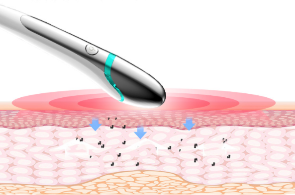 Title 1, Oogmassage Pen Schoonheidsinstrument Vermindert...