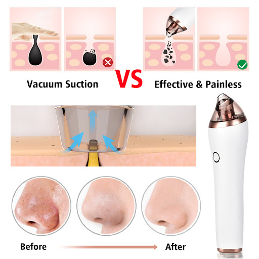 Title 3, Electric Blackhead Facial Cleansing and Beauty ...