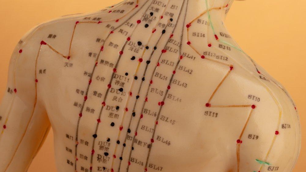 D:\الوخز بالابر\acupuncture-is-viewed-in-different-ways-1576690308.jpg