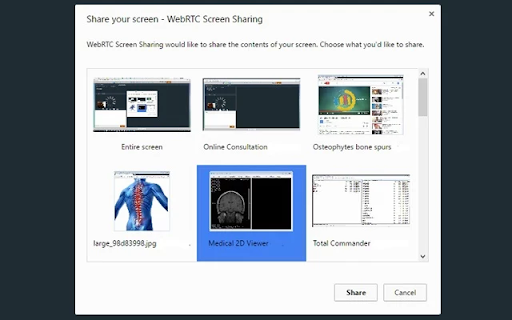 tEMed WebRTC Screen Sharing