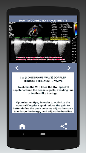 Screenshot AORTIC STENOSIS PROTOCOL GUIDE