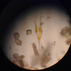 Dinoflagellate