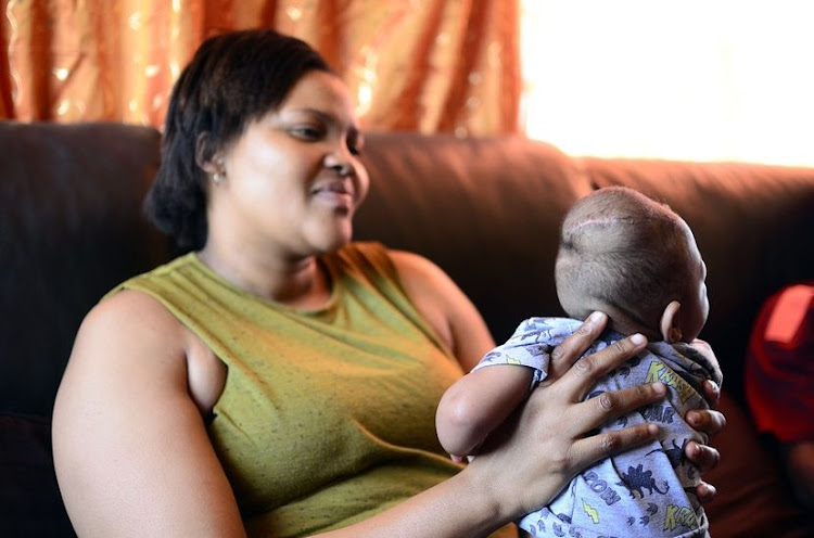 Baitshepi Leselo with her son Goitsemodimo Leselo at their home in Vryburg, after going a through a successful operation that doctors declared impossible. Photo: Tiro Ramatlhatse