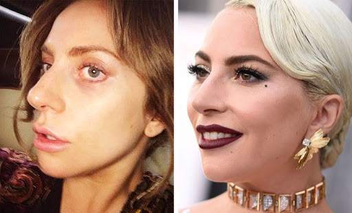 <i>© ladygaga / Instagram © ROBYN BECK / AFP / East News </i>