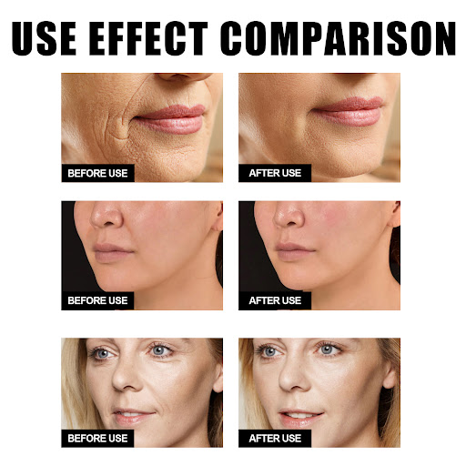 Title 5, Anti-Wrinkle Whitening Liquid Firming Skin Redu...