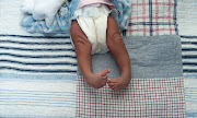 About 2000 children in SA are born with clubfoot every year, a common birth effect, which can cause permanent disability if left untreated.