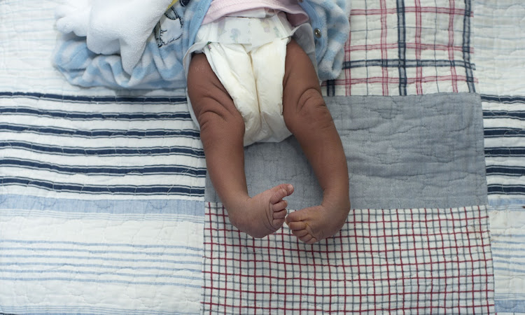 About 2000 children in SA are born with clubfoot every year, a common birth effect, which can cause permanent disability if left untreated.