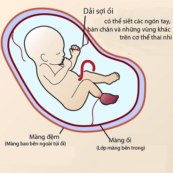 dải sợi ối 