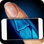 Cover Image of Tải xuống Simulator X-Ray Fingers Joke 1.5 APK