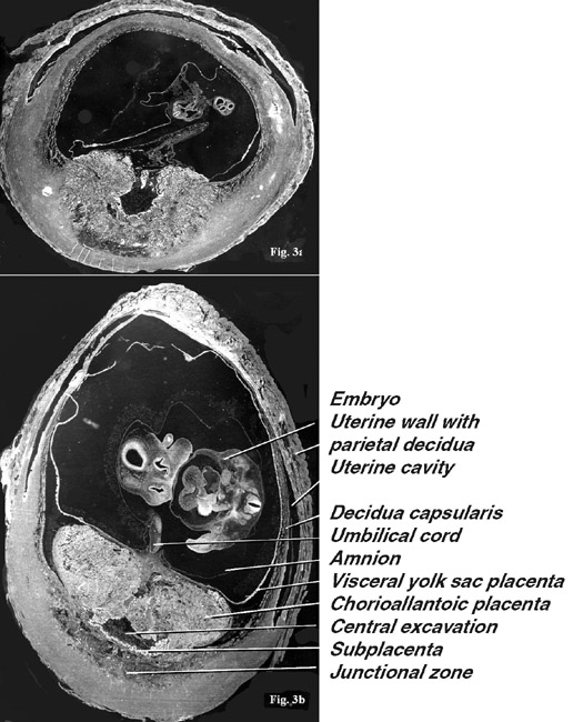 Figure 3: Two cross sections of deep frozen implantation sites of the guinea pig on day 14 (Top) and day 25 (Bottom) post conception.