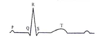 Cardiac Cycle