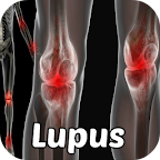 Lupus Symptoms Disease logo