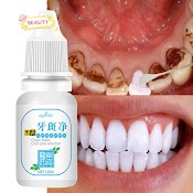 Tinh Chất Làm Trắng Răng 10Ml An Toàn Cho Sức Khỏe