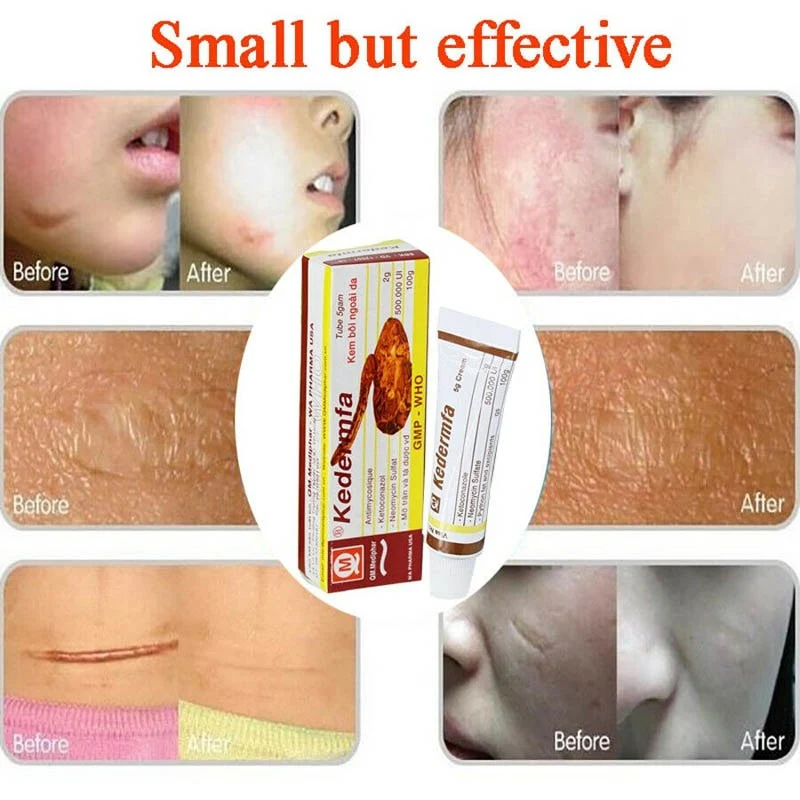 Vietnamese originele slangenvel handcrème en moisturizer 5g, voor hydratatie en verzorging van de huid, zachte handen.